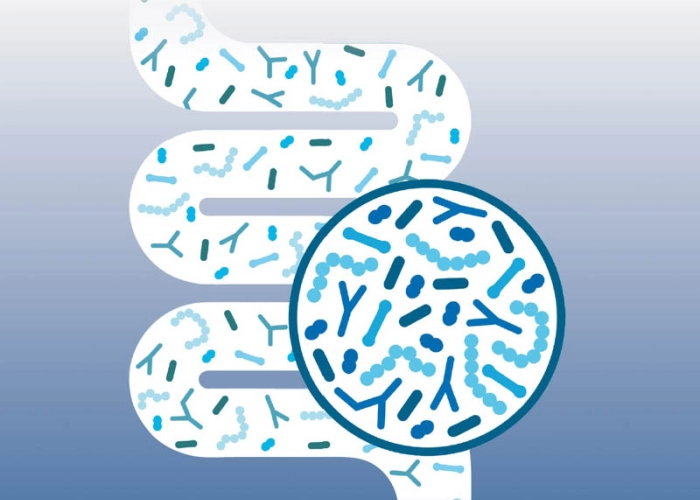 darmflora-plus-select-darmflora-plus-select-intens-post-66acd732d479e111020986